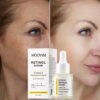 Anti-Aging Serum – Reverse Skin Aging