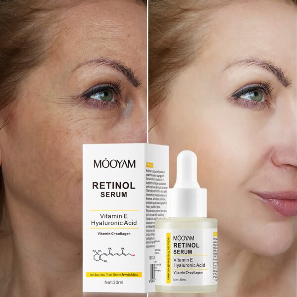 Anti-Aging Serum – Reverse Skin Aging